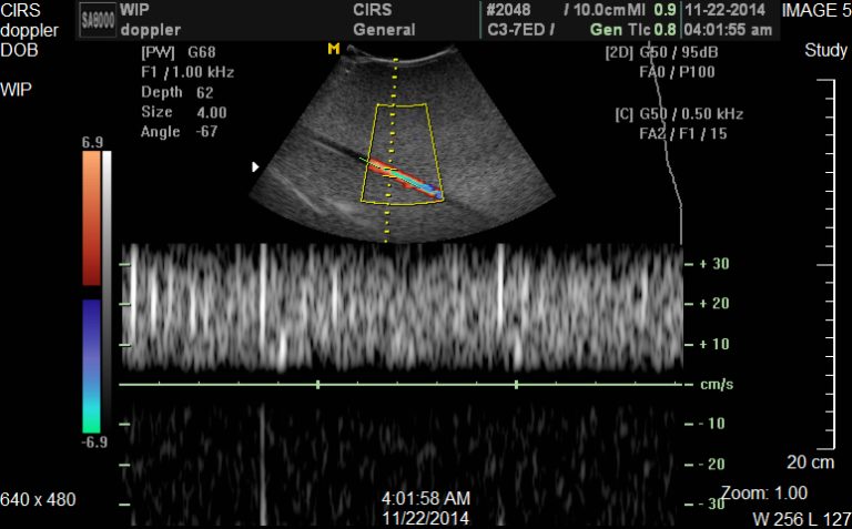 Doppler Flow Pump - CIRS